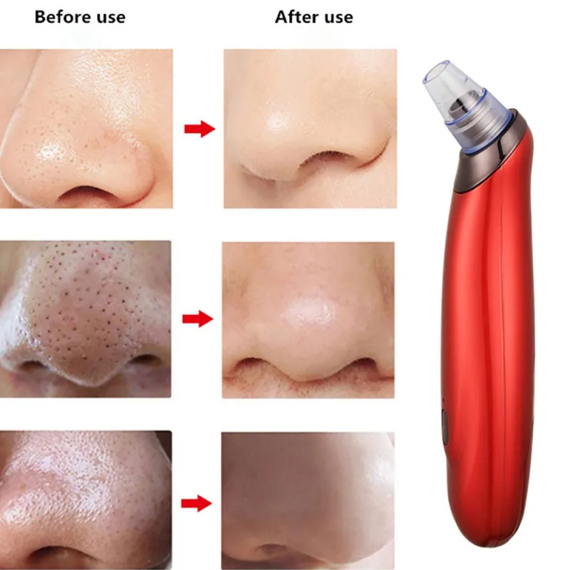 Electric-Blackhead-Remover-Machine-Instrument-Vacuum-Black-Head-Acne-Remover-Tool-Beauty-Face-Skin-Care-3 (4)