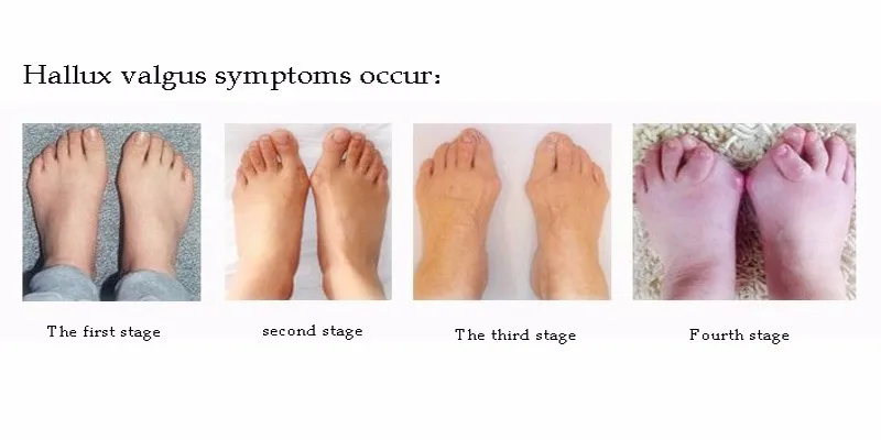 HTB1dNtXLpXXXXbjXXXXq6xXFXXXA