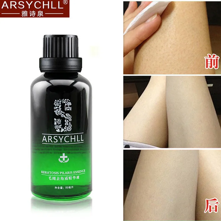 Beely Exfoliator Essence Remover Goose Bumps Repair Hair Follicles