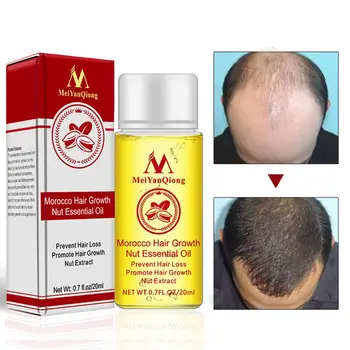 

Fast Powerful Hair Growth Essence Hair Loss Essential Oil Liquid Treatment Preventing Hair Loss Hair Care Products