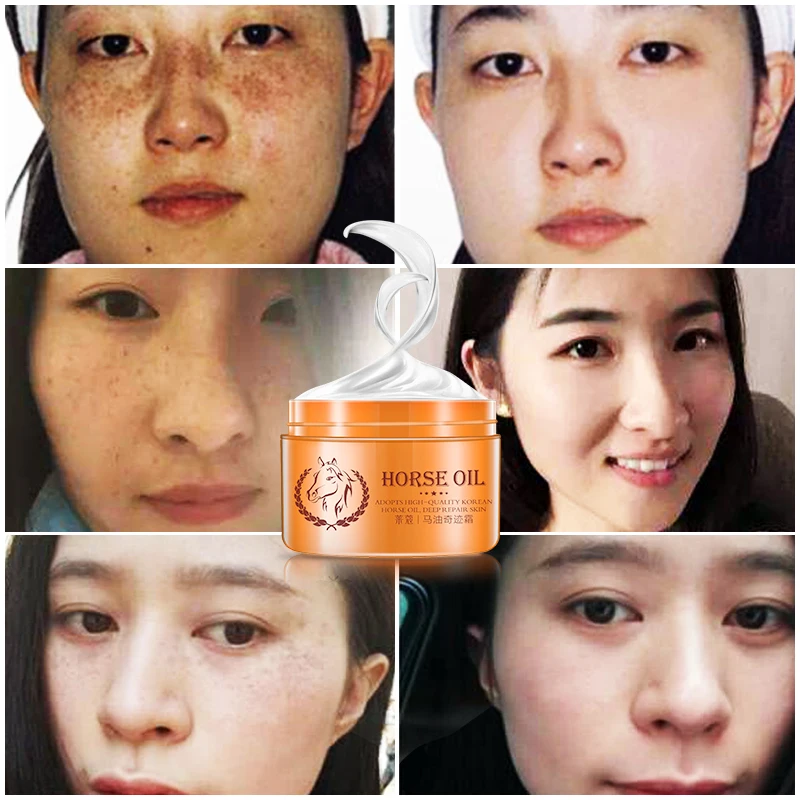 

Face Moisturizers, Moisturizing Cream For Oily Skin Anti-Freckle Cream Strong Whitening Horse Oil Facial Cream Dark