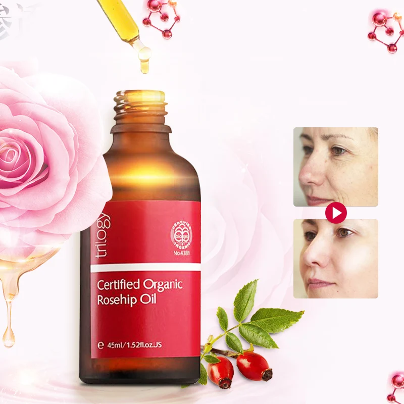 100Original NewZealand Trilogy Certified Organic Rosehip Oil for Scars Fine lines Wrinkles
