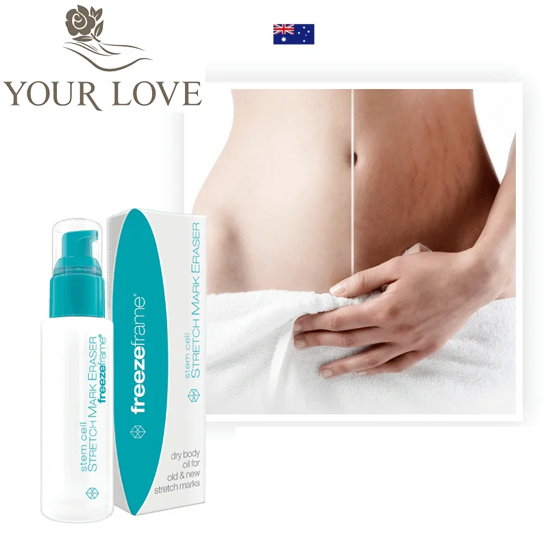 

YourLove Stem Cell Stubborn Treatment Old New Stretch Mark Eraser Damaged skin Clearer Smoother Looking skin