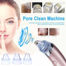 Удаление угрей вакуумный очиститель пор Электрический очищение от акне отшелушивающая очистка Comedo вакуумный очиститель пор Прямая поставка