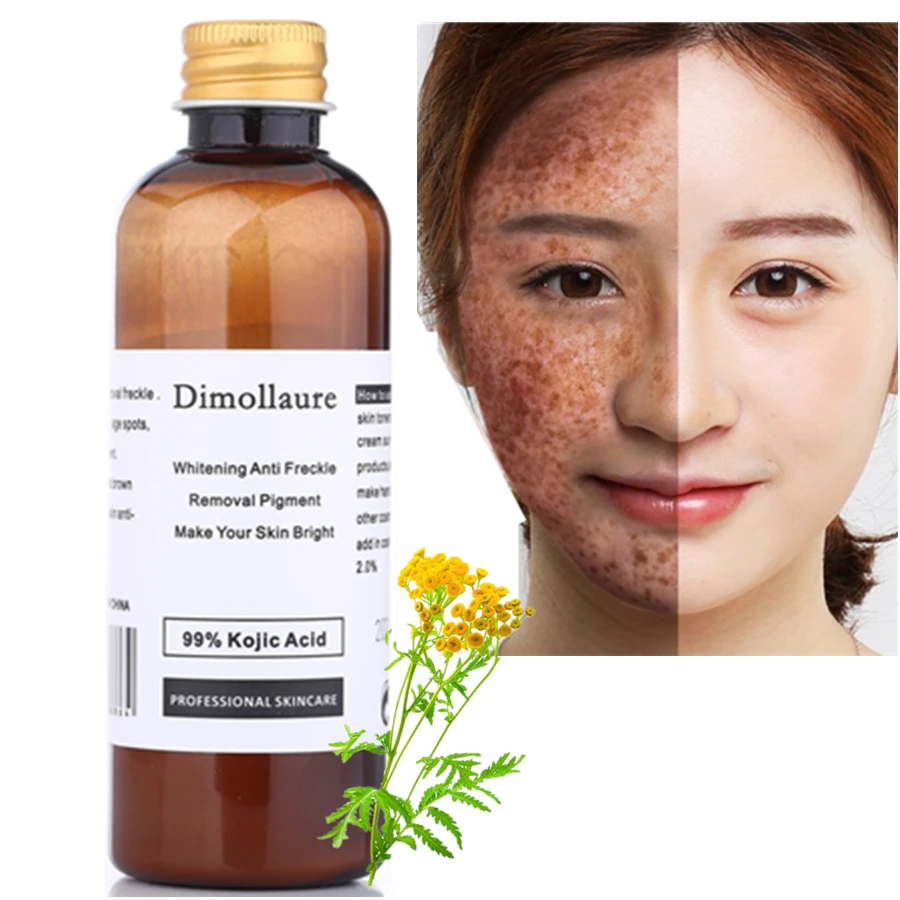 Dimollaure 50g pure 99 Kojic Acid face care whitening cream remove