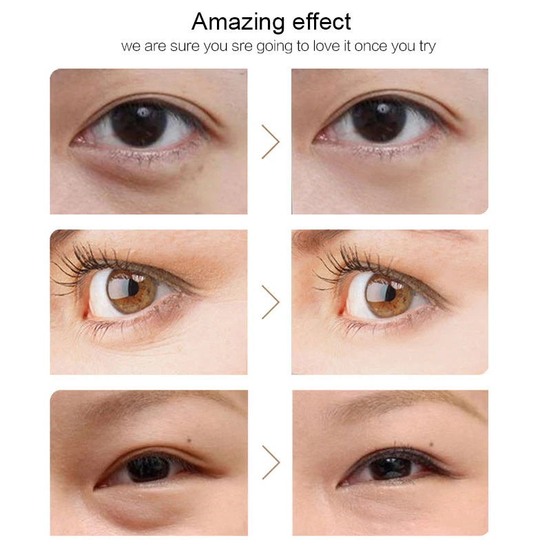“ Creme para os Olhos Peptídeos Anti Rugas Remover Círculo