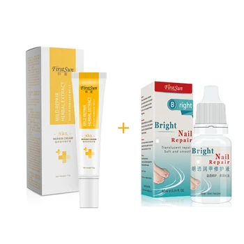

New 2pcs Fungal Nail Treatment Feet Care Essence Whitening Toe Nail Fungus Removal Gel Anti Infection Paronychia Onychomycosis
