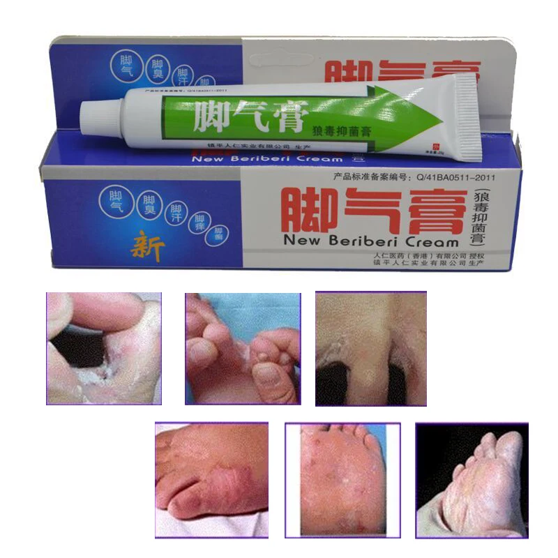 Beriberi Remove Peeling Anti Itch Athlete's Foot Odor Erosion Blister Ointment Sterilization