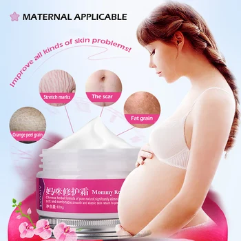 

AFY Remove Pregnancy Scars Acne Cream Stretch Marks Treatment Maternity Repair Anti-Aging Anti Winkles Firming Body Creams TSLM1