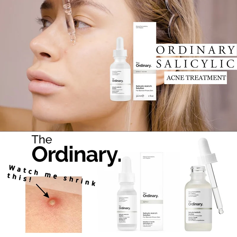

The Ordinary Salicylic Acid 2% Solution 30 mL Acne Treatment Pimple Blemishes Removal Facial Peel Exfoliating