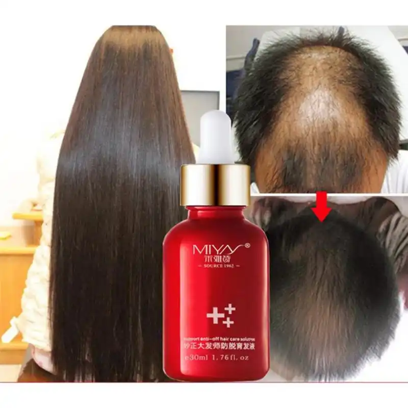 Hair Growth Oils Growth Essence Advanced Thinning Loss Supplement