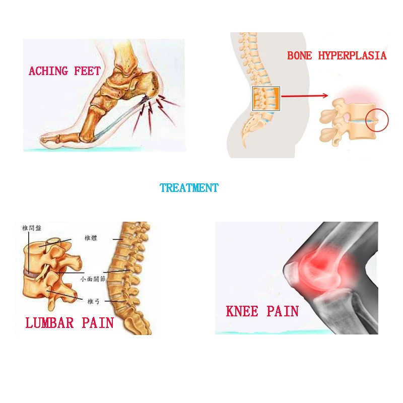 24 шт. обезболивающие пластыри ортопедические пластыри обезболивающие пластыри массажер для тела лечение ревматизма артрита боли в талии