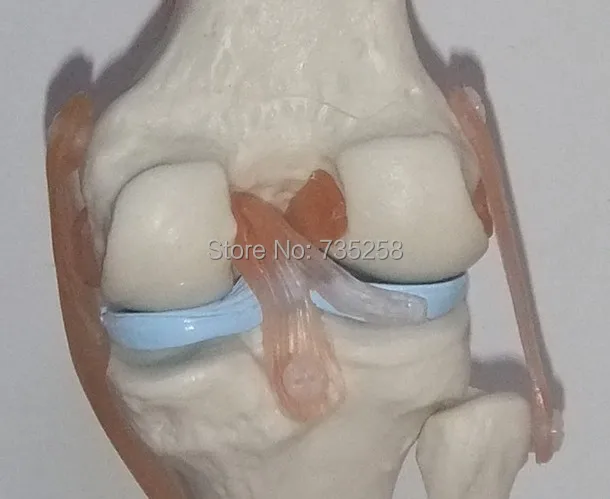 Коленный сустав, модель Связки колена, модель коленного сустава