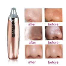 USB Черноголовых вакуумных вакуума для удаления угрей шрам акне пор пилинг лица чистой кожи лица Уход за лицом пылесос