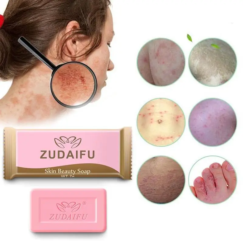 مصغرة 3 قطعة Zudaifu الكبريت الصابون الجلد الزهمي حب الشباب الصدفية الأكزيما مكافحة الفطر حمام صابون مبيض صابون شامبو 7 جرام/قطعة