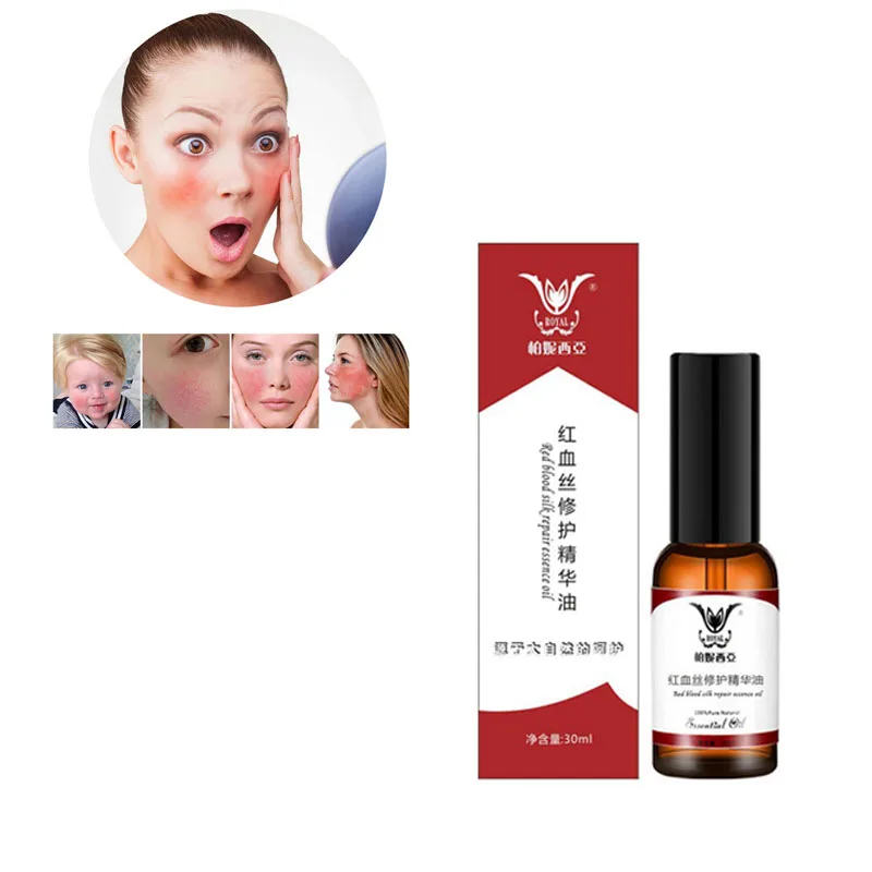 

Face Red Blood Silk Repair Essential Oil Anti-Spider Vein Oil Face Redness Soluation Sensitive Skin Treatment Anti Aging Essence