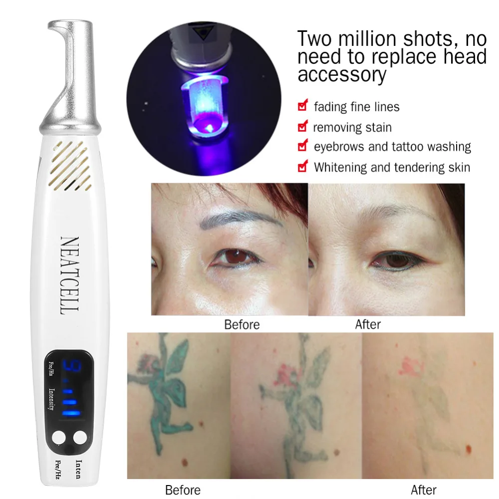

Picosecond Laser Pen Red Blue Light Therapy Tattoo Scar Mole Freckle Removal Dark Spot Remover Machine Skin Care Beauty US Plug