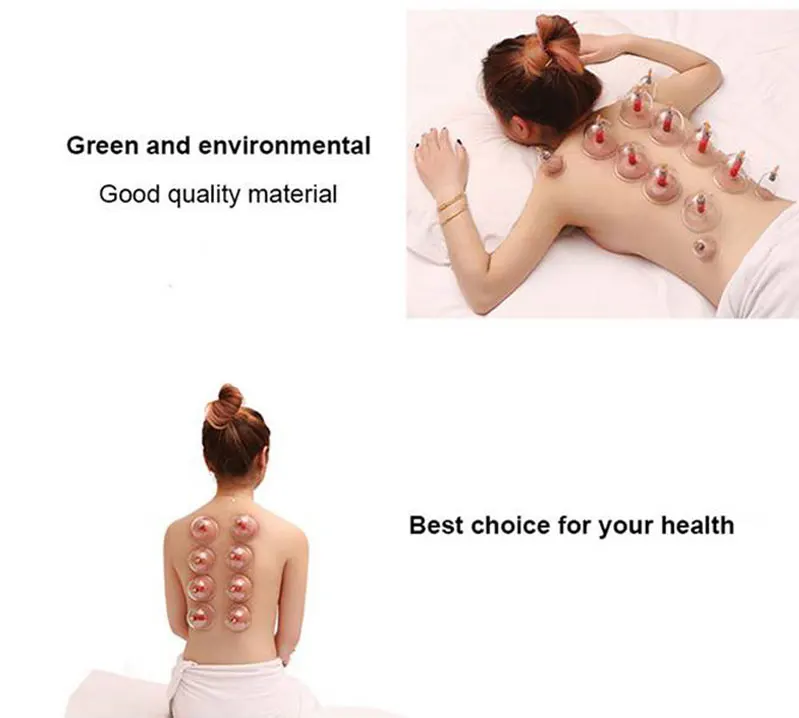 cupping (7)