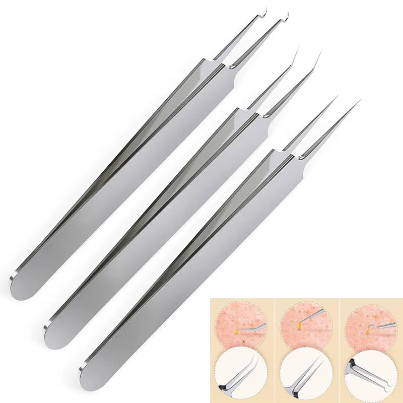 

Professional 3 Pcs Stainless Steel Blackhead Remover Tweezers Professional Comedone Extractor Set HJL2018