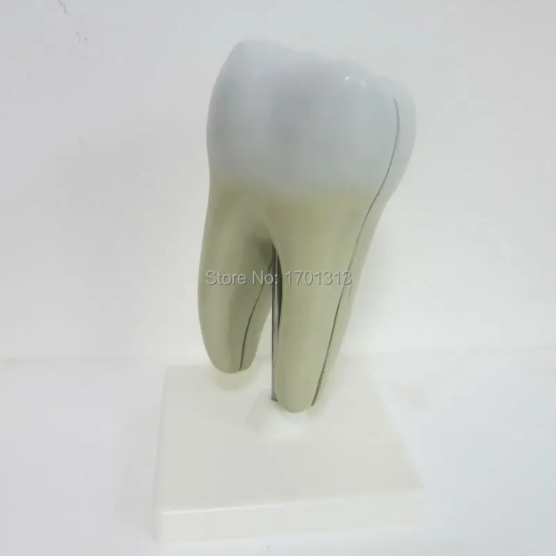 Один яркий Зуб Модель стоматологическая клиника Украшения Специальные украшения на заказ статуэтки для медицинской школы