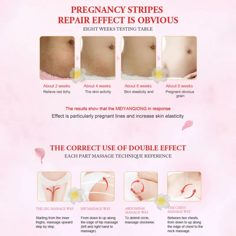 7days Stretch Marks Cream Scar Removal Smooth Skin Cream for Maternity Skin Repair Body Cream Remove Scar Care