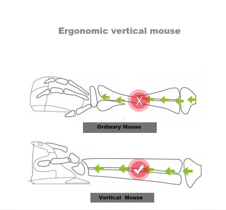 Ergonomic vertical mouse 01