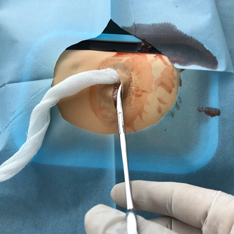 Physician skills abscess incision drainage practice model medical teaching training demonstration silicone skin model