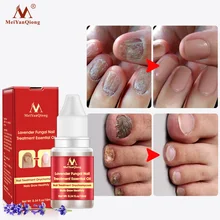 10ml leczenie grzybicy paznokci anty grzybicze paznokieć naprawa pielęgnacja olejek lawendowy KG66