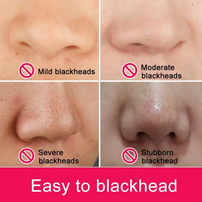 Бамбуковый Уголь черная грязевая маска blackhead для удаления прыщей крем для лица Лечение глубокое очищение грязевая HJL2018