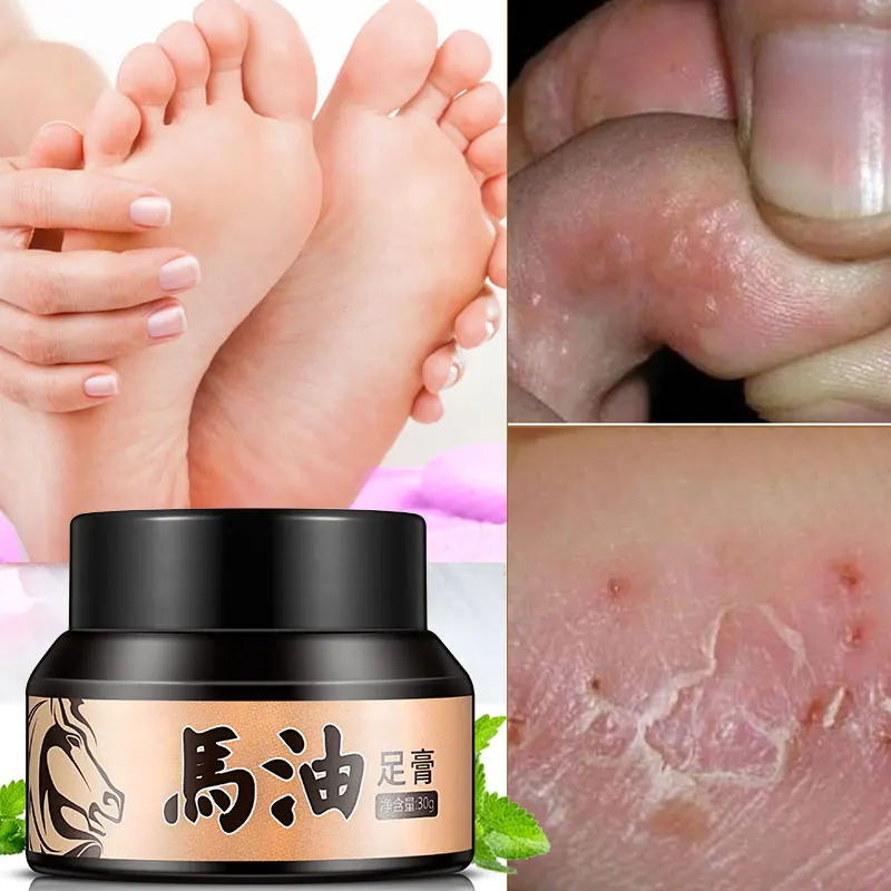 

Higo Horse Oil Feet Pedicure Cream Anti-chapping Peeling off To Be Whitening Skin Repairing Foot Mask Moisturizing Cream