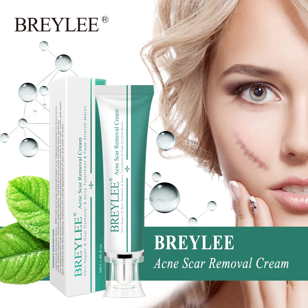 BREYLEE шрама крем 30 г крем для лица Skin ремонт уход за кожей шрам лечение акне удаление стрейч Знаки отбеливающий крем