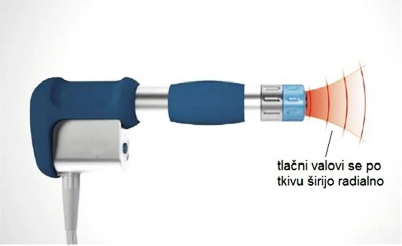 Физическая система боли акустическая Ударная Волна exterorporeal Shockwave машина для боли рельефный питчер 8 бар бесконечные снимки