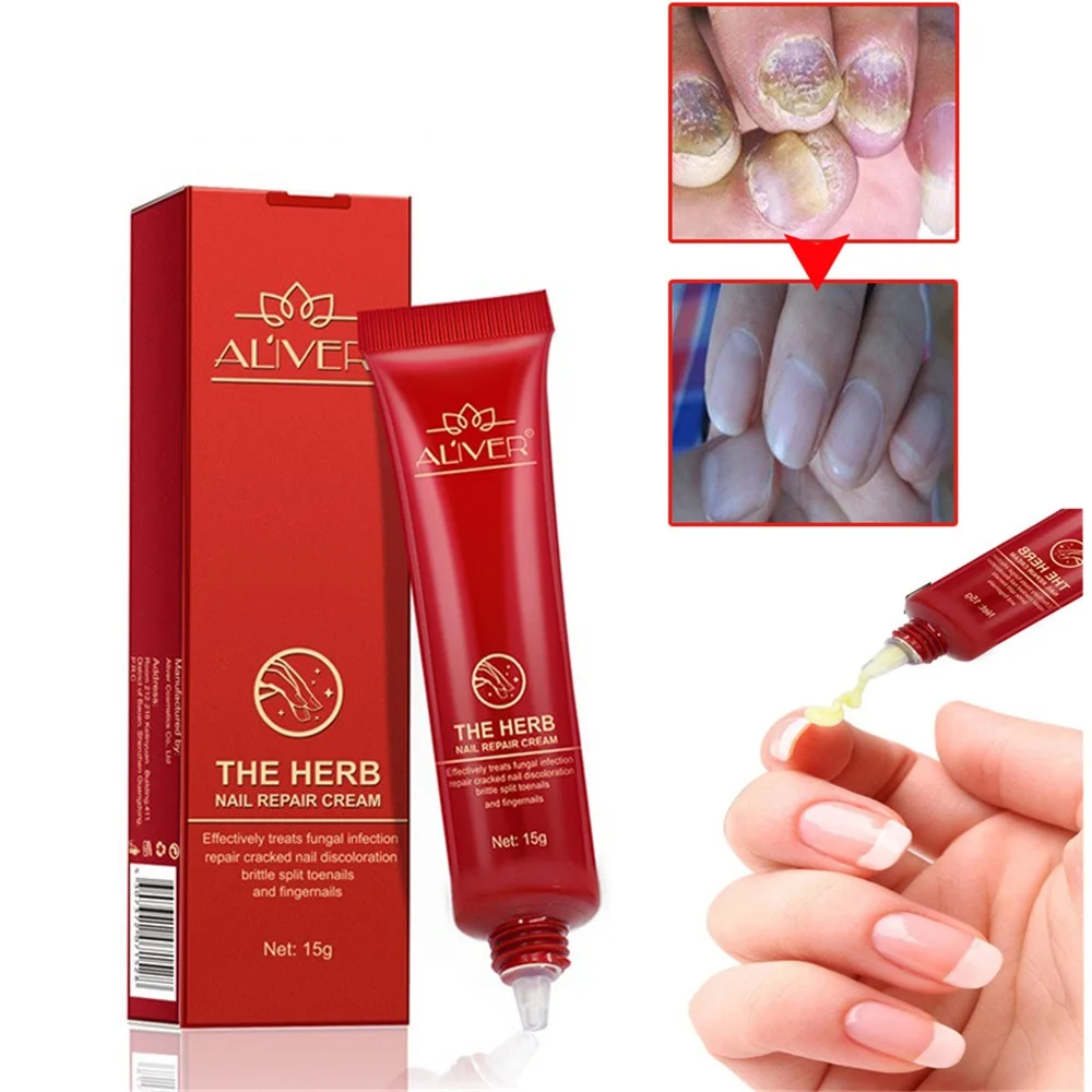 15g High Quality Nail Protector Essence Finger Skin Care Cream Nail
