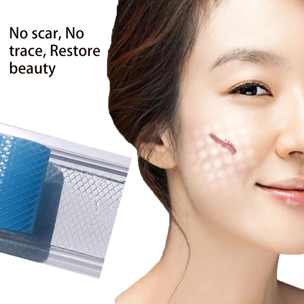 1Pc Silicone Caesarean Section Surgery Removal Scar Sheet Patch Acne Trauma Pregnant postpartum Skin Repair Scar Sheet Patch