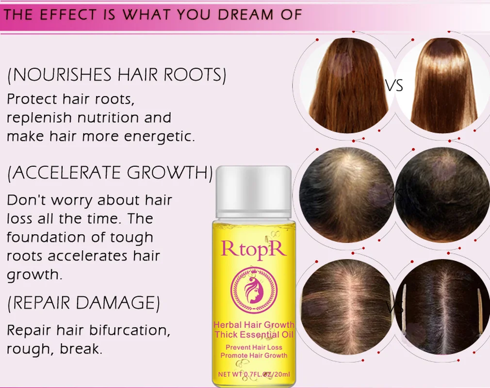 RtopR рост волос от выпадения волос жидкость способствует густому ускоренный рост волос Лечение Эфирное масло здоровье красота эссенция TSLM1