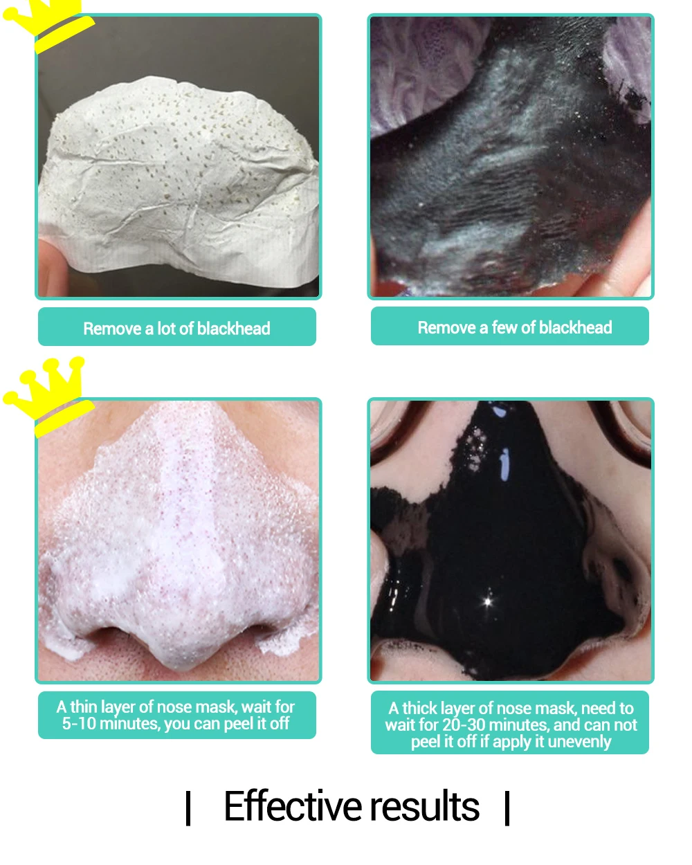 Removedor de Cravo Tratamento da Acne Controle de Óleo de Limpeza Descamação Máscara Lanbena Nariz Pore Faixa Preta Profunda Facial 5 Pcs 10 Beleza e saúde