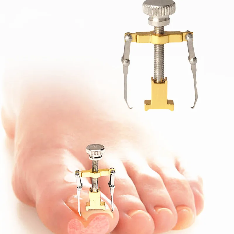 

2019 1Pc Ingrown Toenails Pedicure Foot Care Tools File For Feet Toe Recover Ingrowing Orthotic Nail Bunion Toes Corrector ZY158