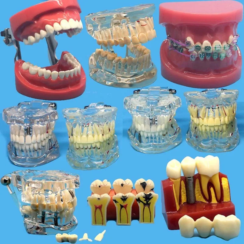 Usados para Ensino e Material de Hospital Material de Dentista Vários Modelos Dentes Dentários São