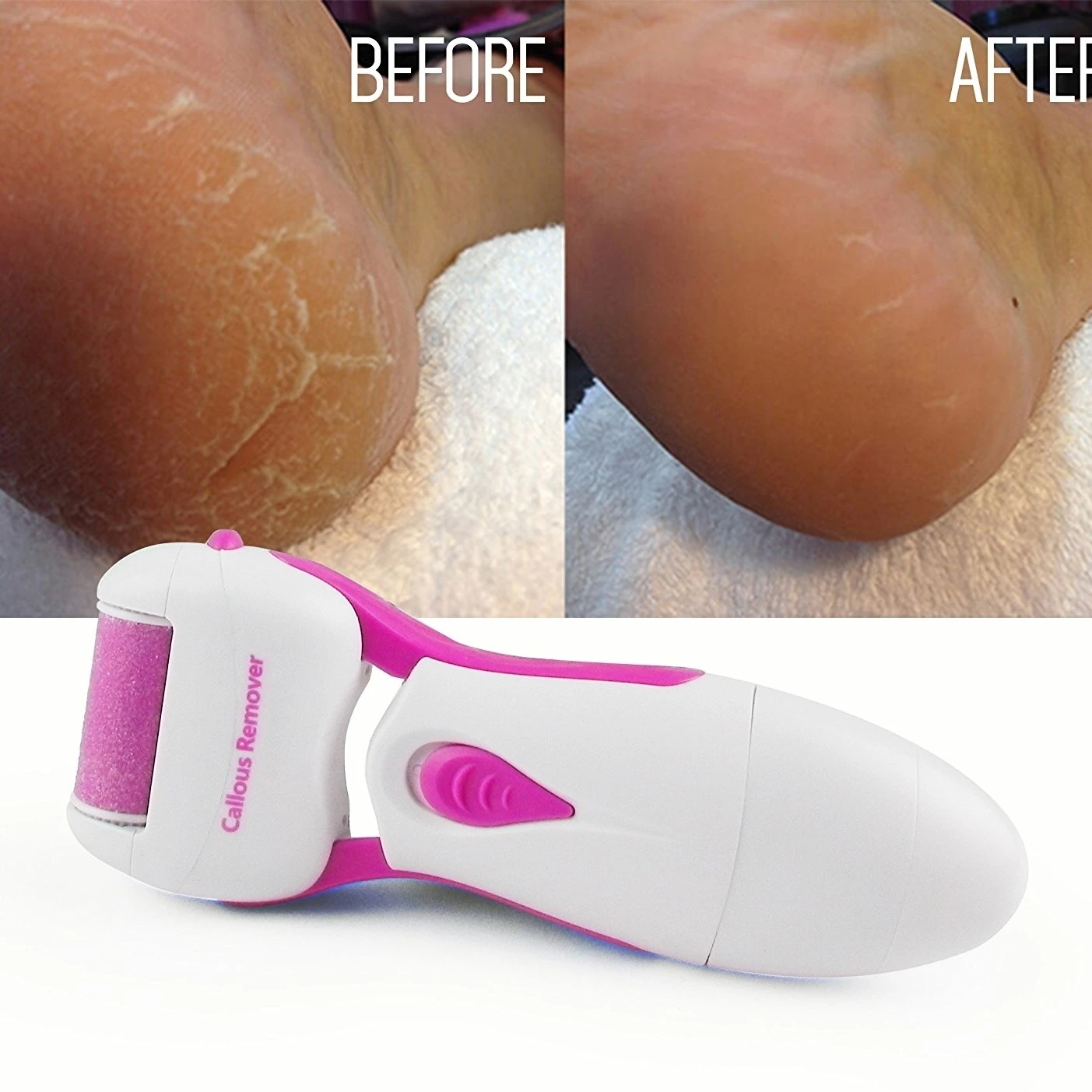 Innovative Battery Powered Personal Pedi Foot Callus Removal To Reduces Wrinkles (1)