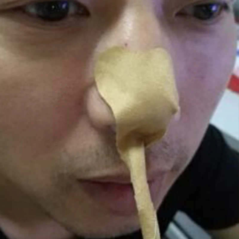Surgical tape for nasal respiration