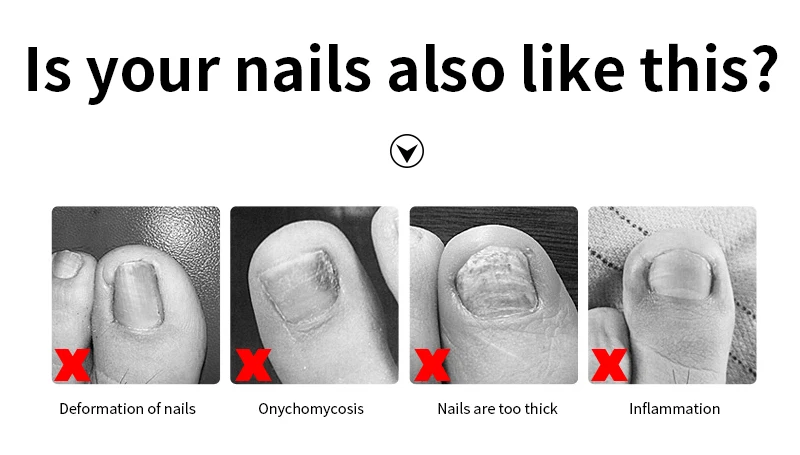 HTB1HzbcfXOWBuNjy0Fiq6xFxVXa7