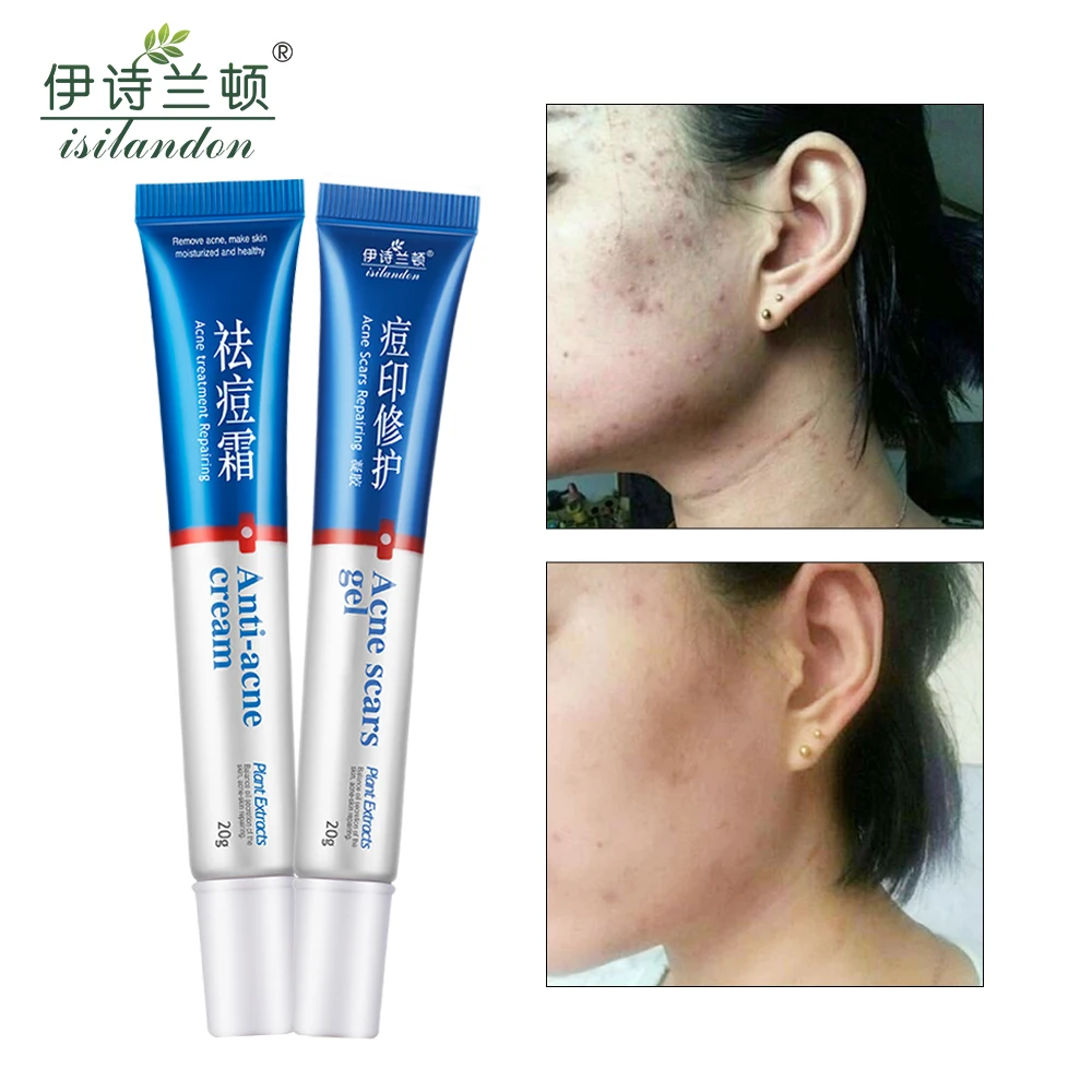ISILANDON Clear Vanishing Acne Treatment Cream+Acne Scars Repairing