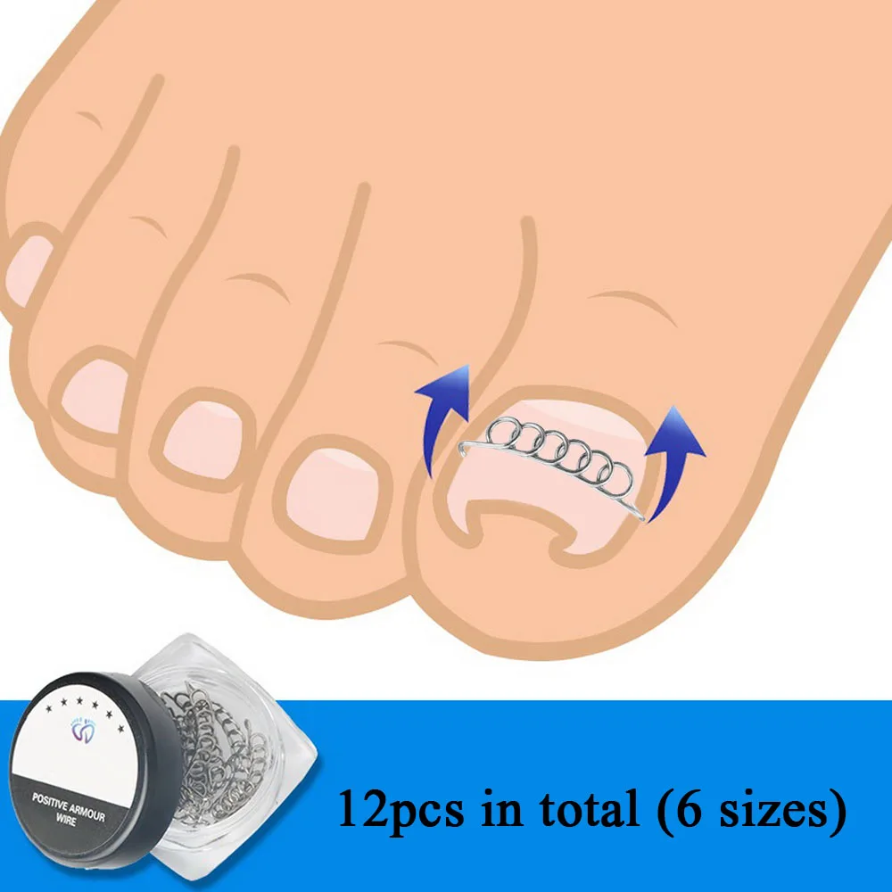 

12Pcs/Box Ingrown Toenail Correction Wire Fixer 6 Sizes Ingrown Toe Corrector Pedicure Treatment Foot Care Tool