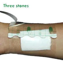 5/10/15/20 см x 5 м высокое качество хирургического Водонепроницаемая повязка на рану пленка pu лента руллон прозрачный пластырь рулон