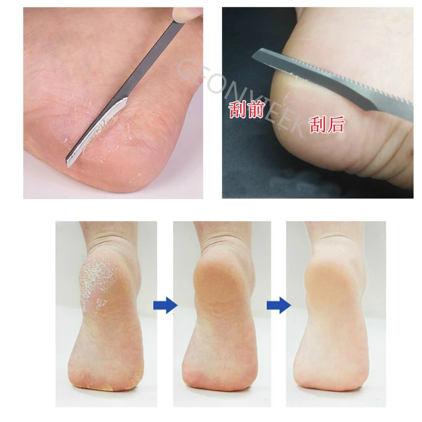 

2018 New Fashion Pedicure Manicure Nail Cleaner Cuticle Grooming Dead Skin Planer Beauty Foot Care Tool