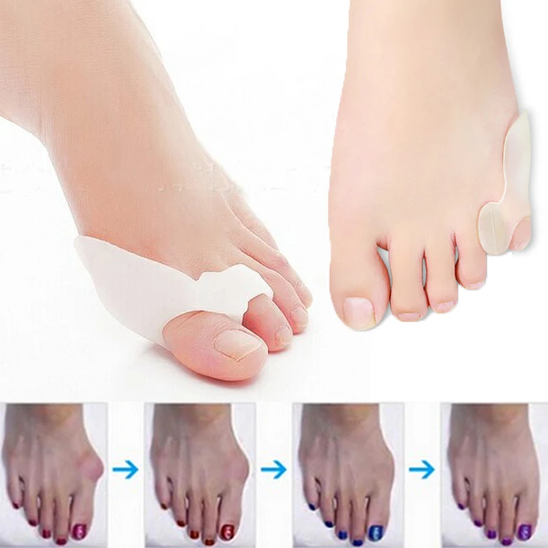 Fashion Care Corrector Braces Hallux Valgus Orthopedic Toe Big Bone Tool Night Use Protector Splint Toe