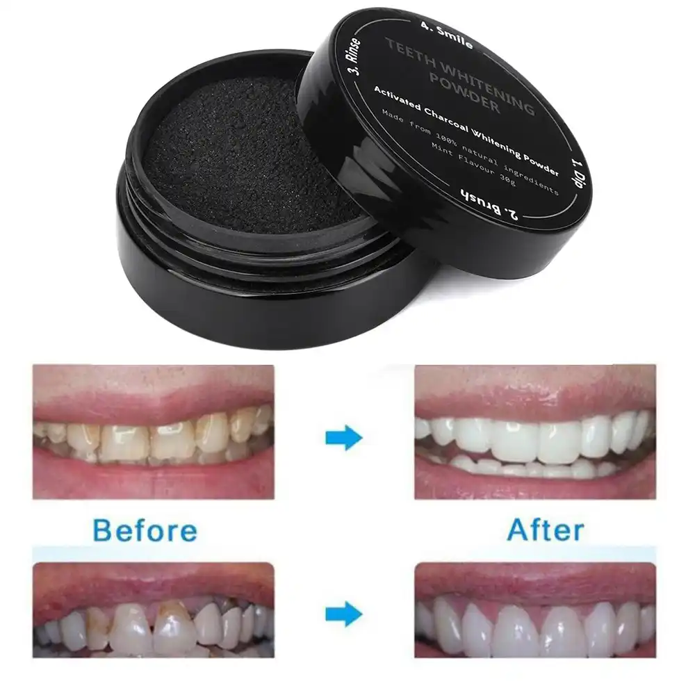 Отбелить зубы активированным углем. Чистили ли зубы углем. Чистили ли зубы углем. Чистили ли зубы углем. Активированный уголь отбеливает зубы.