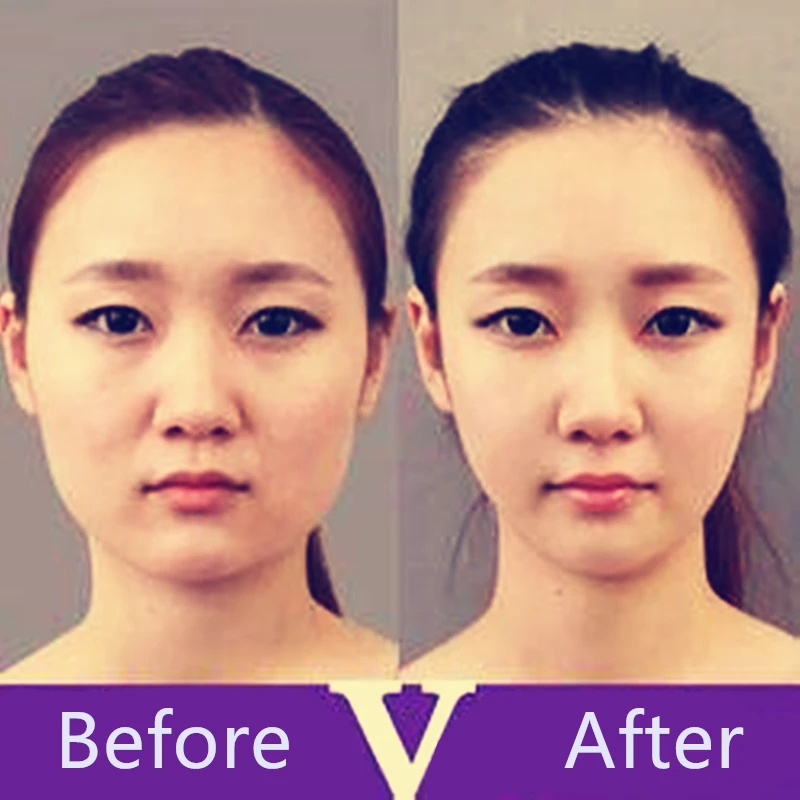 

V Line thin face slim product slimming patch cheek detox weight loss patch for face thinning to reduce cellulite 24pcs/12bags