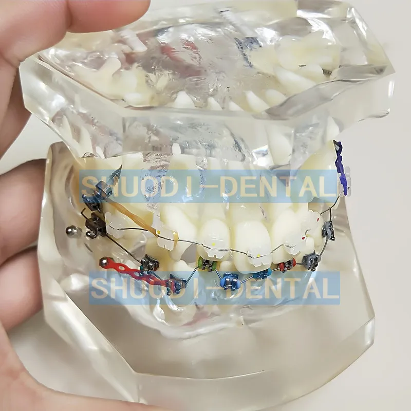 

Transparent Dental Orthodontic Mallocclusion Model with Mental Ceramic Brackets Archwire buccal tube for Patient Communication