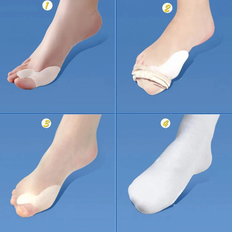 Sumifun 4Pcs Silicone Gel Bunion Splint Big Toe Separator Overlapping Spreader Corrector Hallux Valgus Foot Massager C147